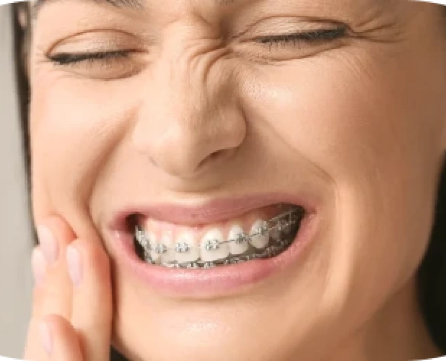Les incidents en orthodontie : conseils du cabinet d'orthodontie du Dr Bocquet à Lille